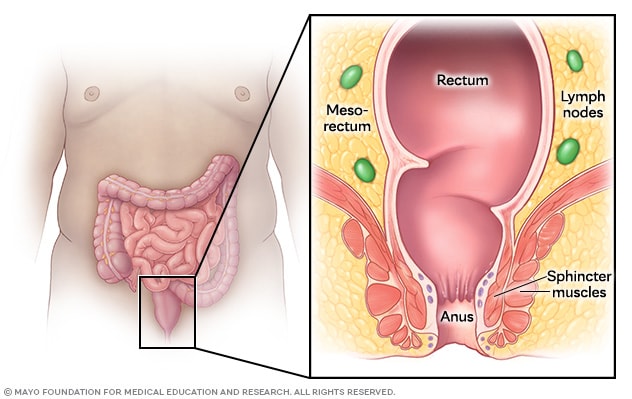 Rectal anatomy, showing the rectum, anus, mesorectum, surrounding lymph nodes and sphincter muscles